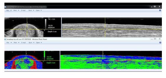 Introduction to UTC (Ultrasound Tissue Characterization) in Equines: